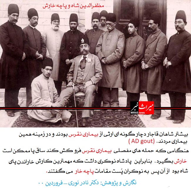 نقرس قاجار و پاچه خار